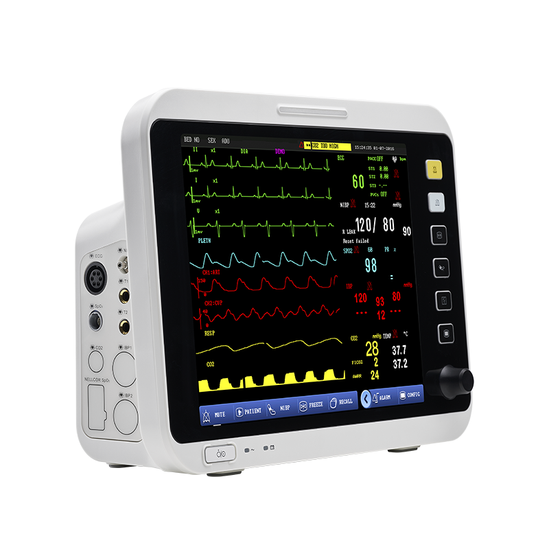 Advanced Patient Monitoring System